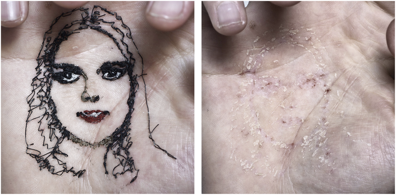 Illustration for article titled Artist embroiders portraits into his own flesh—and then tears them out